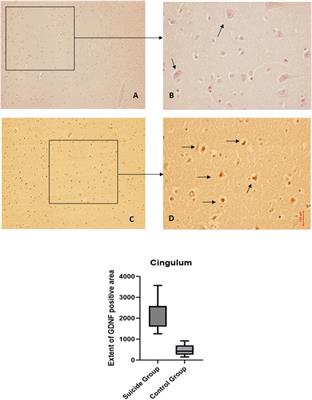The forensic aspects of suicide and neurotrophin factors: a research study
